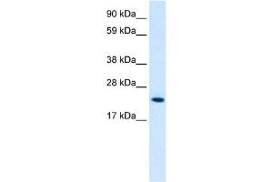 WB Suggested Anti-HMGB3 Antibody Titration:  0. (HMGB3 antibody  (C-Term))