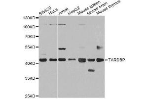 Western blot analysis of extracts of various cell lines, using TARDBP antibody (ABIN6290985) at 1:1000 dilution.