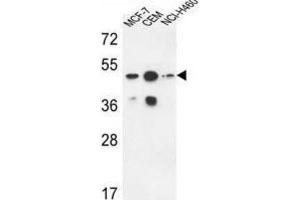 Western Blotting (WB) image for anti-Sphingomyelin Synthase 2 (SGMS2) antibody (ABIN3004329) (Sphingomyelin Synthase 2 antibody)