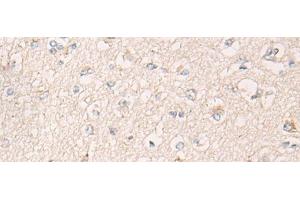 Immunohistochemistry of paraffin-embedded Human brain tissue using IBA57 Polyclonal Antibody at dilution of 1:65(x200)