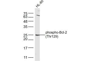 HL-60 cell line lysates probed with Bcl-2 (Thr129) Polyclonal Antibody, Unconjugated  at 1:300 dilution and 4˚C overnight incubation. (Bcl-2 antibody  (pThr129))