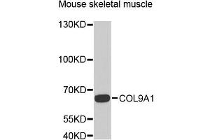 Western blot analysis of extracts of mouse skeletal muscle, using COL9A1 antibody (ABIN5975036) at 1/1000 dilution. (COL9A1 antibody)