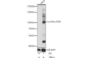 Western blot analysis of extracts of HeLa cells, using Phospho-IKKα-S180 antibody (ABIN6135203, ABIN6136048, ABIN6136049 and ABIN6225542) at 1:1000 dilution. (IKK alpha antibody  (pSer180))