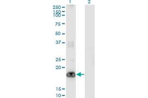 Western Blot analysis of PIGH expression in transfected 293T cell line by PIGH monoclonal antibody (M01), clone 2F8. (PIGH antibody  (AA 89-188))