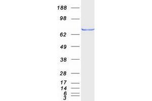 EWSR1 Protein (Transcript Variant EWS) (Myc-DYKDDDDK Tag)