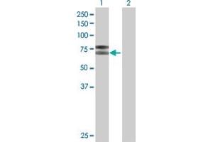 Western Blot analysis of IL2RB expression in transfected 293T cell line by IL2RB MaxPab polyclonal antibody. (IL2 Receptor beta antibody  (AA 1-551))