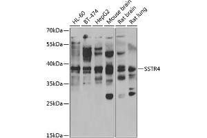 Western blot analysis of extracts of various cell lines, using SSTR4 antibody (ABIN6129726, ABIN6148502, ABIN6148503 and ABIN6222751) at 1:1000 dilution. (SSTR4 antibody  (AA 314-388))