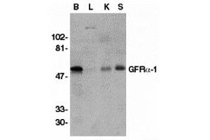 Western Blotting (WB) image for anti-GDNF Family Receptor alpha 1 (GFRA1) (Middle Region) antibody (ABIN1030937) (GFRA1 antibody  (Middle Region))