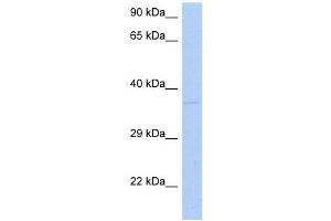 DRG1 antibody used at 1 ug/ml to detect target protein. (DRG1 antibody  (N-Term))