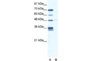 WB Suggested Anti-GLIS2 Antibody Titration: 2.