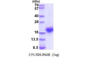 SDS-PAGE (SDS) image for Cystatin F (Leukocystatin) (CST7) (AA 20-1452) protein (His tag) (ABIN5854283) (CST7 Protein (AA 20-1452) (His tag))