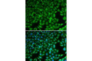 Immunofluorescence analysis of U2OS cells using NDRG1 antibody. (NDRG1 antibody  (AA 175-394))
