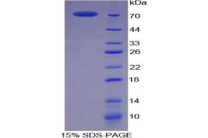 SDS-PAGE analysis of Pig CKM Protein.