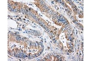 Immunohistochemical staining of paraffin-embedded Kidney tissue using anti-ARHGDIA mouse monoclonal antibody. (ARHGDIA antibody)