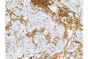 Immunohistochemistry (IHC) image for anti-CD38 (AA 43-300) antibody (ABIN7453961) (Recombinant CD38 antibody  (AA 43-300))