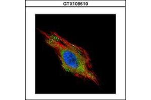 Image no. 2 for anti-Charged Multivesicular Body Protein 2B (CHMP2B) (AA 1-213) antibody (ABIN1497503) (CHMP2B antibody  (AA 1-213))
