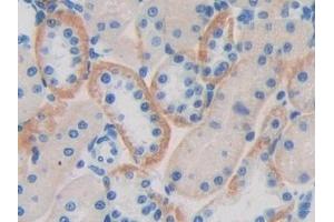 Detection of CD244 in Rat Kidney Tissue using Polyclonal Antibody to Cluster of Differentiation 244 (CD244) (2B4 antibody  (AA 20-221))