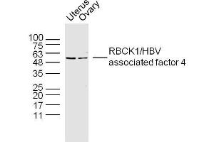 Lane 1: Mouse uterus lysate, Lane 2: mouse overy lysate probed with RBCK1 Polyclonal Antibody, unconjugated  at 1:300 overnight at 4°C followed by a conjugated secondary antibody for 60 minutes at 37°C. (RBCK1 antibody  (AA 251-350))