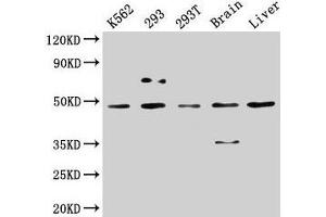 Casein Kinase 1 delta antibody  (Isoform delta)