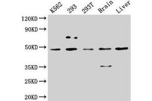 Western Blot Positive WB detected in: K562 whole cell lysate, 293 whole cell lysate, 293T whole cell lysate, Rat brain tissue, Mouse liver tissue All lanes: CSNK1D antibody at 5 μg/mL Secondary Goat polyclonal to rabbit IgG at 1/50000 dilution Predicted band size: 48, 47 kDa Observed band size: 48 kDa (Casein Kinase 1 delta antibody  (Isoform delta))