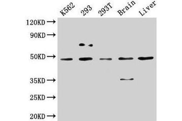 Casein Kinase 1 delta antibody  (Isoform delta)