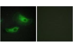 Immunofluorescence (IF) image for anti-Adducin 2 (Beta) (ADD2) (AA 471-520) antibody (ABIN2889855) (ADD2 antibody  (AA 471-520))