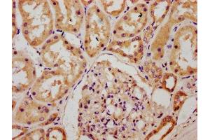 IHC image of ABIN7147645 diluted at 1:300 and staining in paraffin-embedded human kidney tissue performed on a Leica BondTM system. (CHSY1 antibody  (AA 32-148))