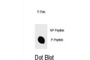 Dot blot analysis of Phospho-IKKB- Antibody Phospho-specific Pab (ABIN1539707 and ABIN2839873) on nitrocellulose membrane.