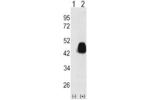 Western blot analysis of PDX1 antibody and 293 cell lysate either nontransfected (Lane 1) or transiently transfected with the PDX1 gene (2). (PDX1 antibody  (AA 1-30))