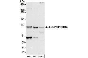 anti-Lon Peptidase 1, Mitochondrial (LONP1) (AA 909-959) antibody