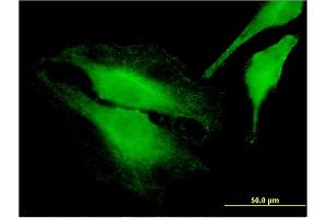 Immunofluorescence of monoclonal antibody to FARP1 on HeLa cell. (FARP1 antibody  (AA 471-549))
