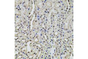 Immunohistochemistry of paraffin-embedded rat kidney using SMARCC2 antibody. (SMARCC2 antibody)