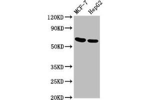 Western Blot Positive WB detected in: MCF-7 whole cell lysate, HepG2 whole cell lysate All lanes: GNAS antibody at 3.