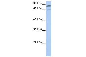 Mitofusin 2 antibody used at 1 ug/ml to detect target protein. (MFN2 antibody  (C-Term))