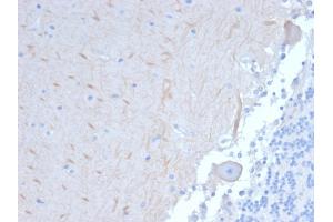 Formalin-fixed, paraffin-embedded human Brain stained with ATG5 Mouse Monoclonal Antibody (ATG5/2101). (ATG5 antibody  (AA 1-119))