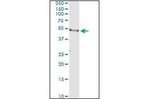 Western Blotting (WB) image for anti-CD177 Molecule (CD177) antibody (ABIN781918) (CD177 antibody)