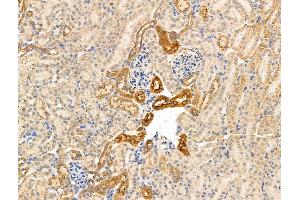 anti-kappa Light Chain antibody
