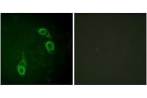 Immunofluorescence analysis of HepG2 cells, using APC1 (Ab-688) Antibody. (APC1 antibody  (AA 654-703))