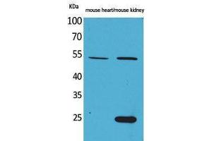 Western Blotting (WB) image for anti-Secretogranin III (SCG3) (N-Term) antibody (ABIN3178173) (SCG3 antibody  (N-Term))