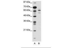 Image no. 1 for anti-Zinc Finger and SCAN Domain Containing 2 (ZSCAN2) (N-Term) antibody (ABIN6736118) (ZSCAN2 antibody  (N-Term))