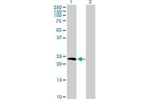 Western Blot analysis of HPCA expression in transfected 293T cell line by HPCA MaxPab polyclonal antibody. (Hippocalcin antibody  (AA 1-193))