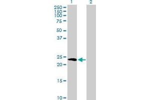 Hippocalcin antibody  (AA 1-193)