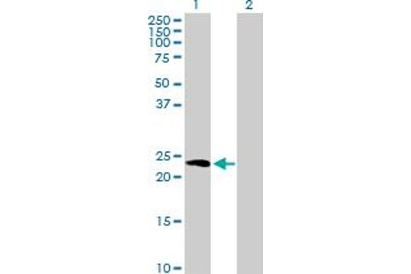 Hippocalcin antibody  (AA 1-193)