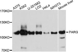 Western blot analysis of extracts of various cells, using PARG antibody. (PARG antibody)
