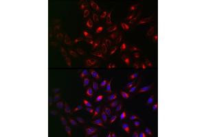 Immunofluorescence analysis of U2OS cells using VAPB Rabbit pAb (ABIN6132783, ABIN6150058, ABIN6150059 and ABIN6221003) at dilution of 1:100 (40x lens). (VAPB antibody  (AA 10-222))