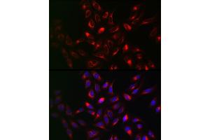 Immunofluorescence analysis of U2OS cells using VAPB Rabbit pAb (ABIN6132783, ABIN6150058, ABIN6150059 and ABIN6221003) at dilution of 1:100 (40x lens). (VAPB antibody  (AA 10-222))