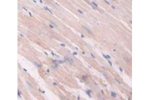 Figure. (MYL7 antibody  (AA 11-148))