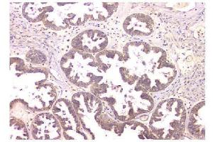 IHC analysis of WWOX using anti-WWOX antibody (ABIN6719627). (WWOX antibody  (AA 1-245))