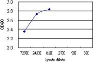 S100A8 (Human) Matched Antibody Pair