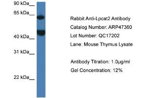 Western Blotting (WB) image for anti-Lysophosphatidylcholine Acyltransferase 2 (LPCAT2) (N-Term) antibody (ABIN2782922) (LPCAT2 antibody  (N-Term))